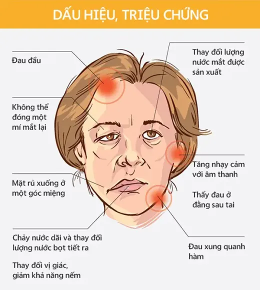 Đau Dây Thần Kinh Số 5 Và Liệt Dây Thần Kinh Số 7: Dấu Hiệu Nhận Biết Và Cách Trị Liệu Tại Phụng Tiên Spa